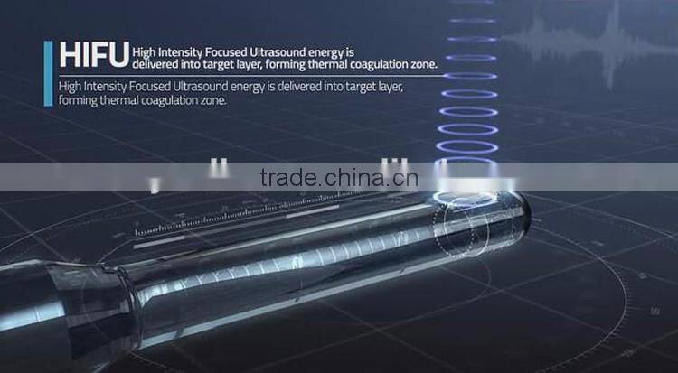 2017 Vaginal Tightening Machine China Supplier 5000 Times HIFU for Sale