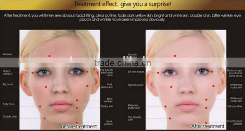 New product Crazy Selling beauty machine instrument