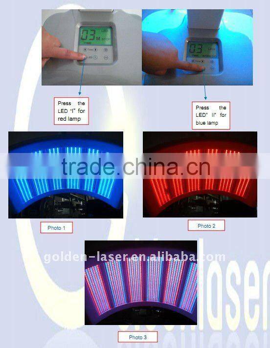Professtion!! Blue Light Acne Therapy Machine