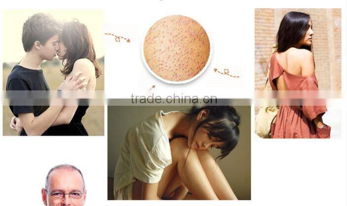 Brand high quality Mendior alpha hydroxy acid Skin Smoother moisturizing Remove Gallinaceous skin Body Lotion OEM custom brand