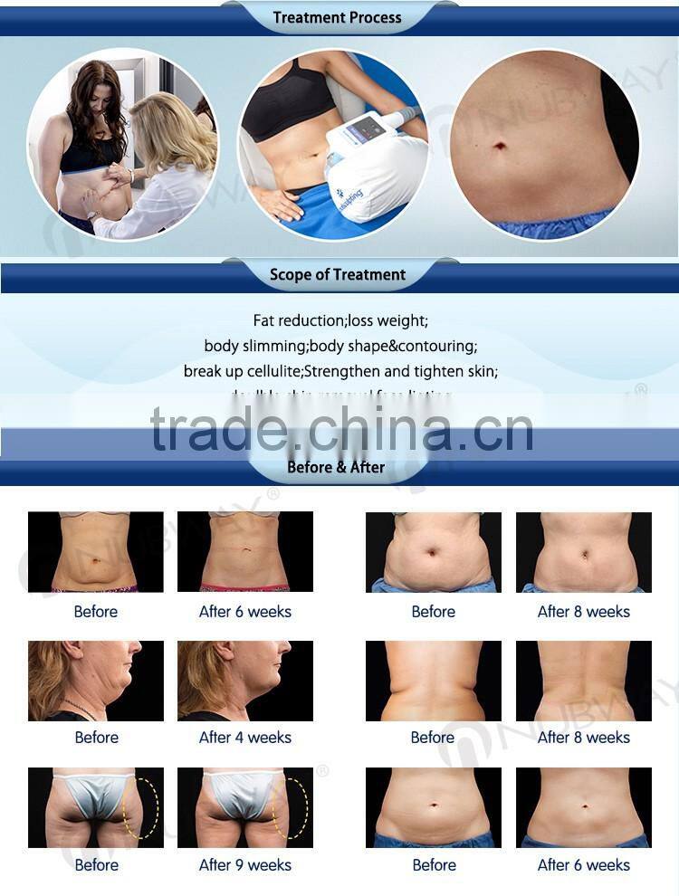 5 cryo treatment handles fat freeze coolshape fat freezing liposuction cryo cryotherapy crylipolysis machine with cavitation