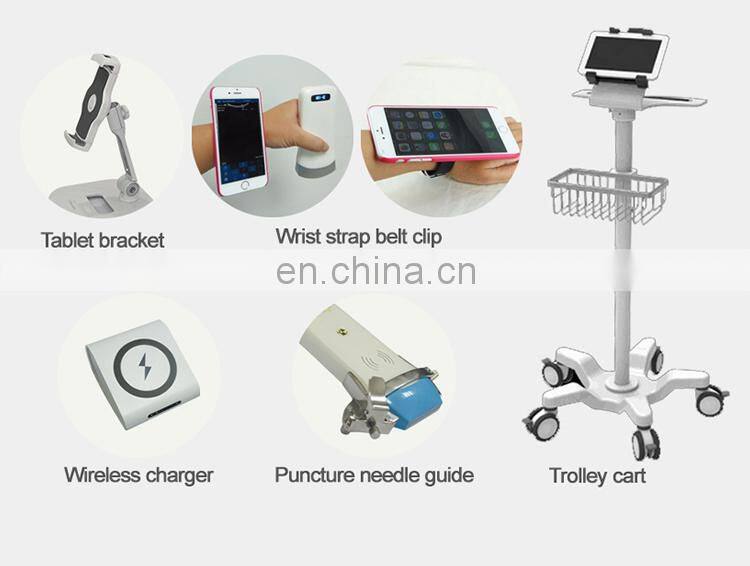 Sales 2022 factory price portable wireless ultrasound scanner ultrasound machine