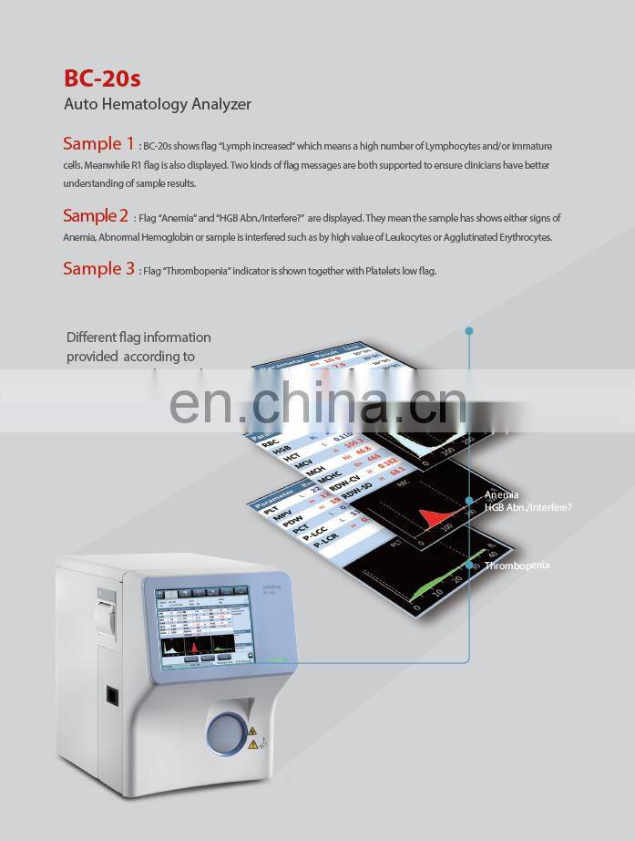 Mindray Auto hematology analyzer mindray bc-20s with wifi port for medical laboratory equipment BC-20S