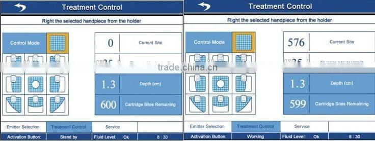 2016 New technology hifu slimming machine / lipo hifu machine