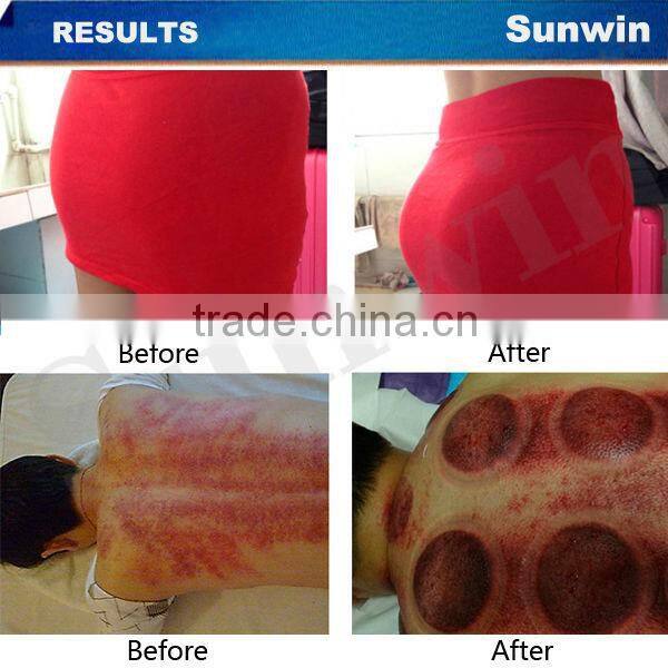 2015 Best breast enlargement device for Increase Breast Size SW-68B