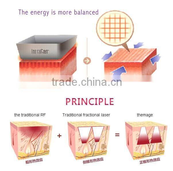 best wrinkle removal skin tightening thermagic microremage