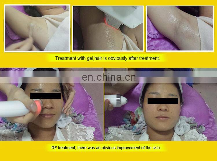 High-Tech Multifunction IPL/Elight RF Skin Tightening Hair Removal Beauty Machine