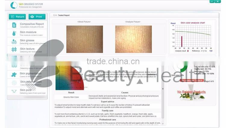 OEM new portable facial skin analyzer machine to check skin health
