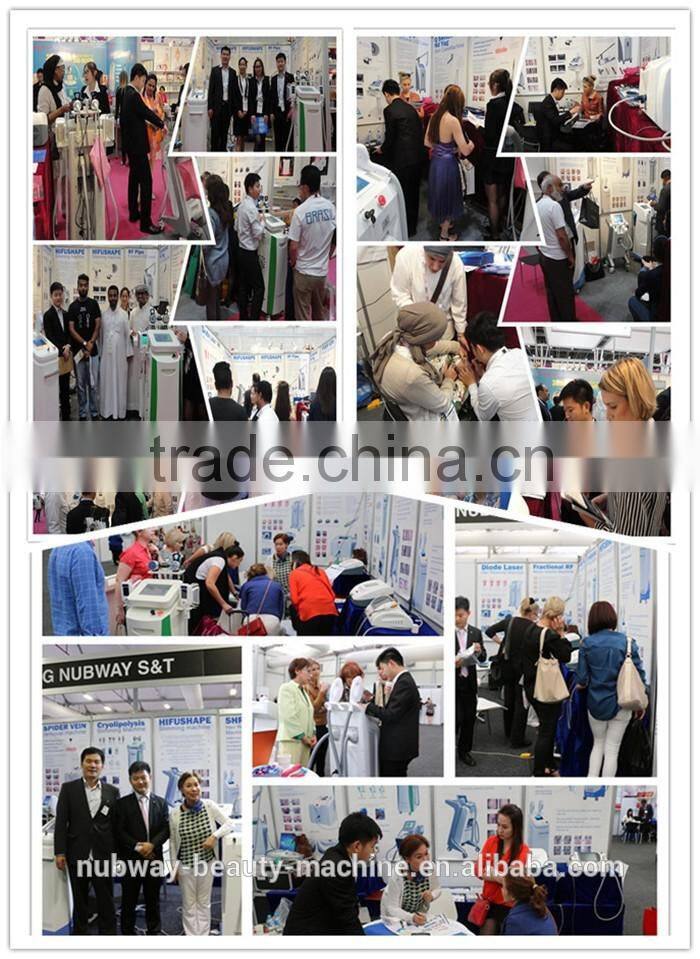 Professtional 1064nm 532nm electronic-optical nd yag laser tattoo removal system