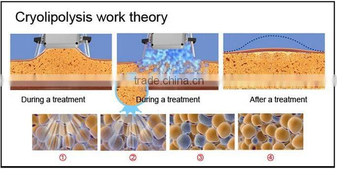 Cryolipolysis Cavitation RF Skin tightening Face Lifting Machine