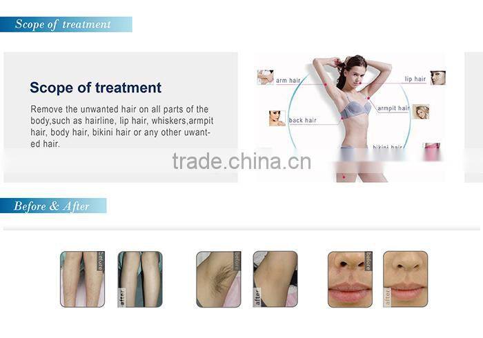 2015 hot sale ce approved 808nm laser hair removal machine alexandrite