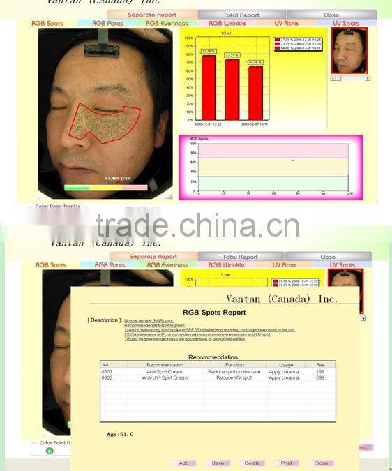 HOT SALE : Auto-digital smart mini skin analyzer handheld skin analyzer