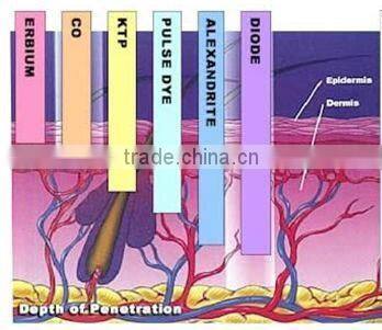 KES Medical CE Painfree 808nm laser hair removal machine diode