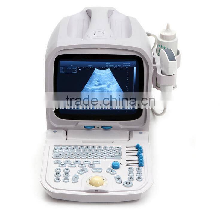 2016 high Quality Digital Portable PC based veterinary Ultrasound Scanner for dog & pig pregnancy