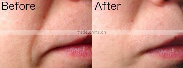 Japanese faces cosmetics for women anti-aging and skin moisturizing