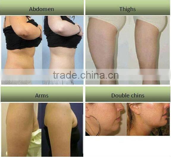 T&B 650nm 10 pads weigh lose slimming lipo laser machine CE