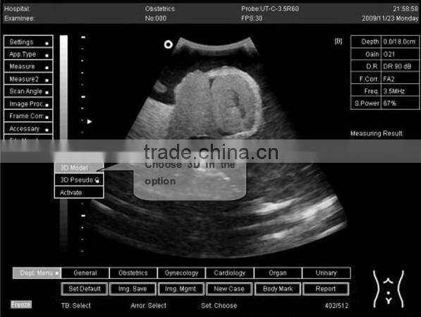Full Digital Laptop Ultrasound Scanner(PC)