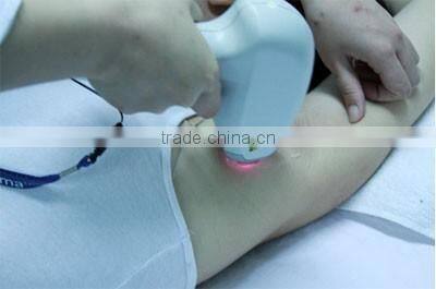 Best diode laser 808nm Permanent Hair Removal machine/808nm diode laser hair removal machine/808nm hair removal device