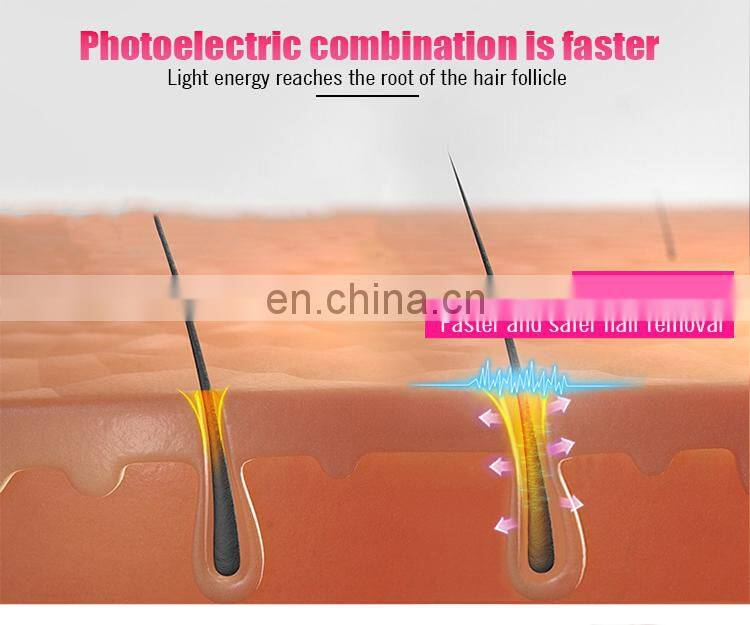 epilator home laser hair removal handheld 808nm diode laser hair removal machine at home