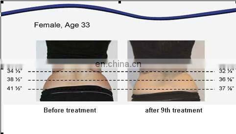 Shape body fat reduce machine for beauty salon