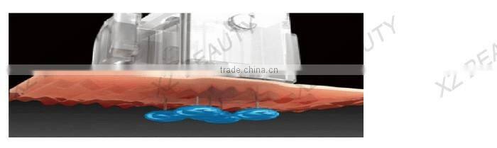 2016 most effective water mesotherapy gun/Needle Meso Gun/mesotherapy gun for Skin Rejuvenation