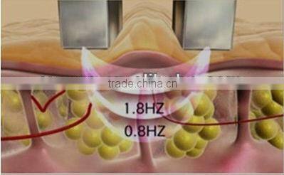 radio frequency beauty skin tightening RF device