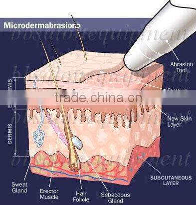 NL-SPA13 Mini water dermabrasion machine for sale Skin Rejuvention Vacuum for sale