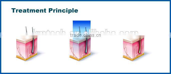 Best sale laser hair removal machine diode