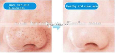 Deep cleaning facial skin care brush scrubber electric facail massager -JTLH-1501