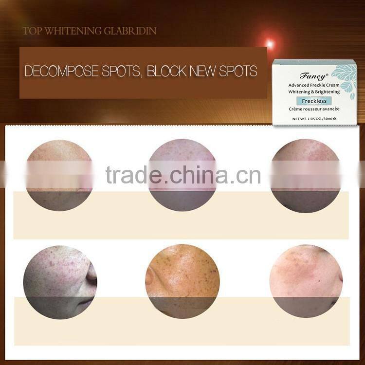 Facial Skin beauty products best modern design face whitening anti freckle cream