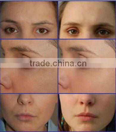 4 In 1 portable home beauty instrument suppliers tm-264