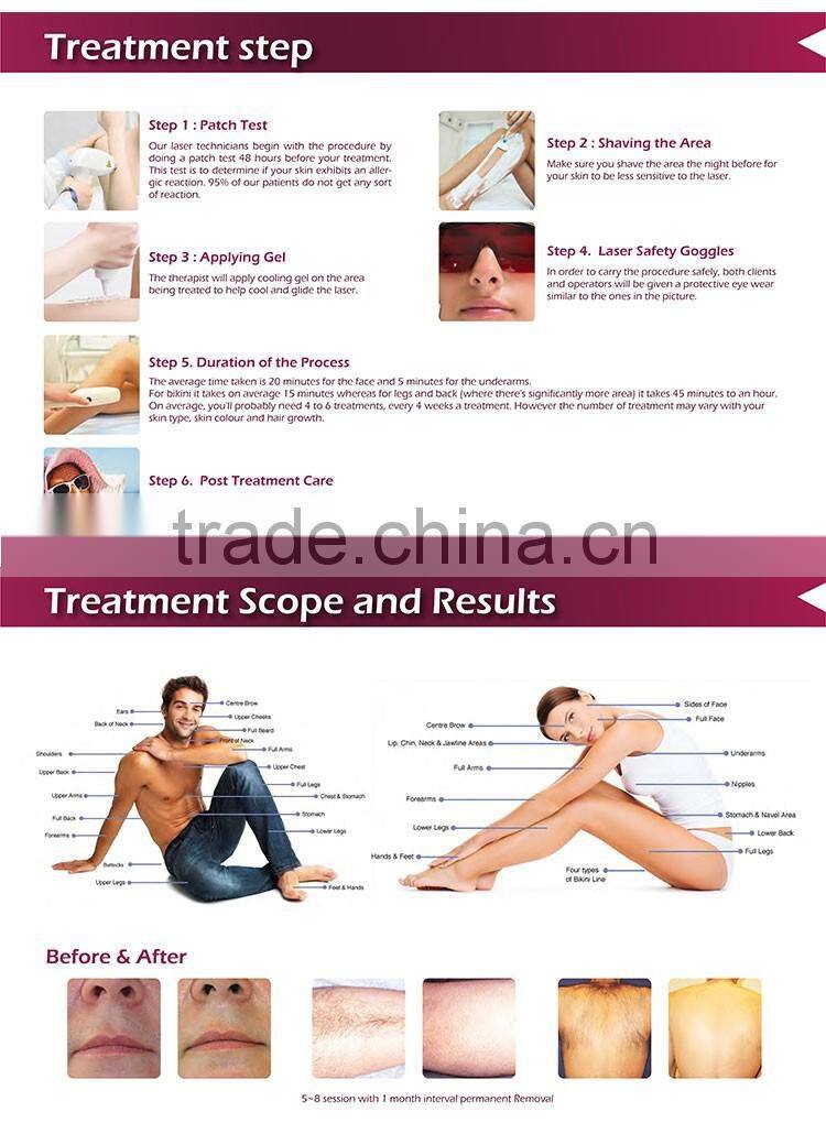 high power unhairing 808nm professional laser diode for whole body depilation