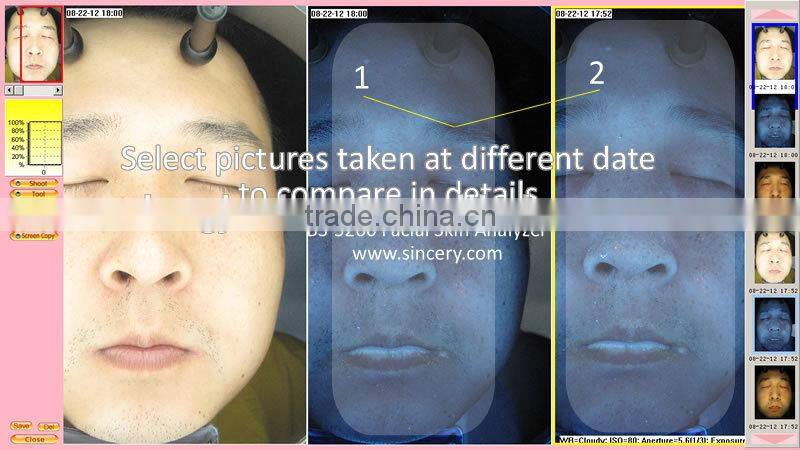 UV Light 3D Face Camera Magic Mirror Skin Analyzer for Face