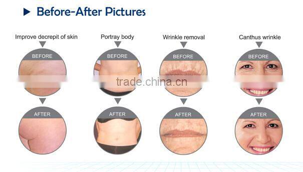 multi-functional RF/40K/ beauty machine Made in China Home&salon use