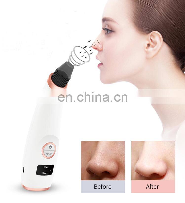 Newest blackhead acne extractor remover kit instrument