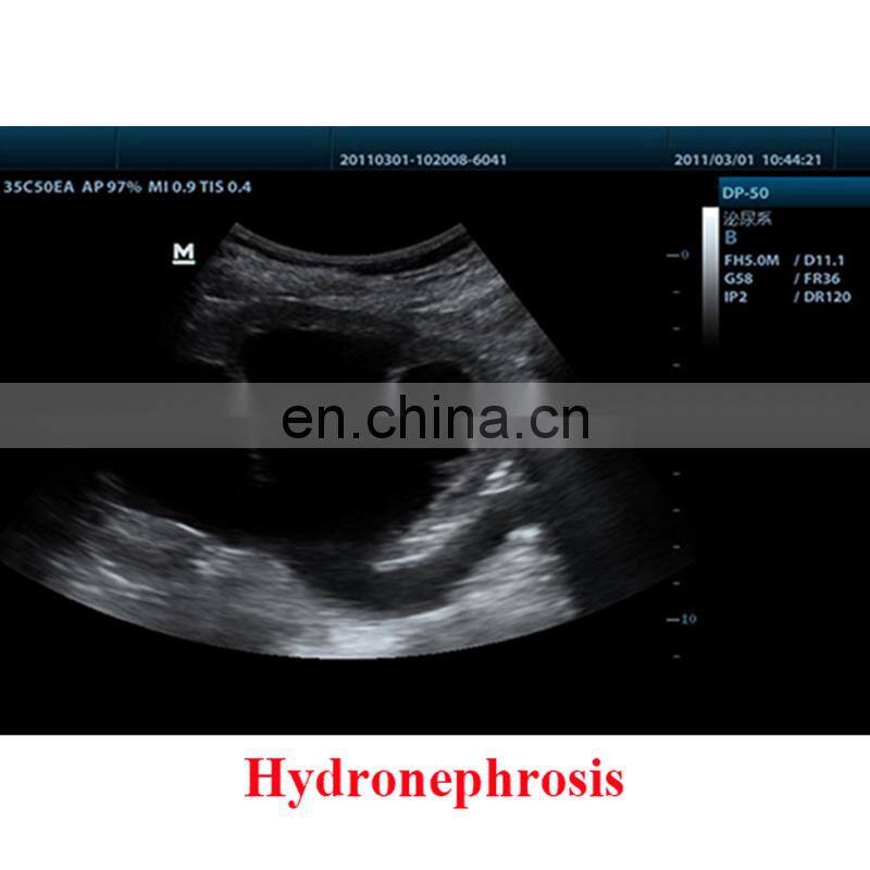 Cheapest Original Mindray DP-50 ultrasound portable ultrasonic diagnosis system/mindary ultrasound