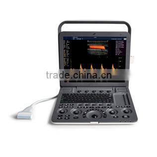 Loptop Fully Digital Ultrasound Scanner Ultrasound scanner Color Doppler