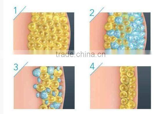 Dual cryo heads cryo lipolisis portable freezing slimming machine CTL76