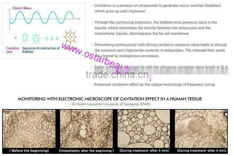 Home use cavitation System skin rejuvenation machine