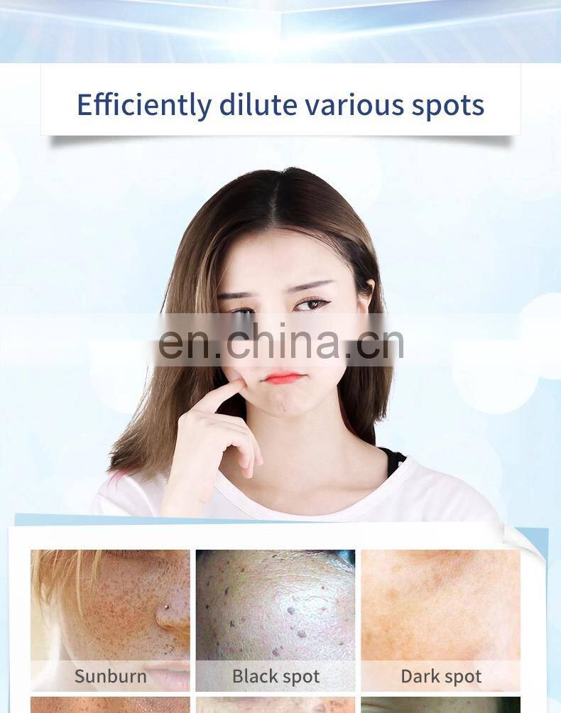 Professional Skin Care Face Cream Freckle Cream For Face