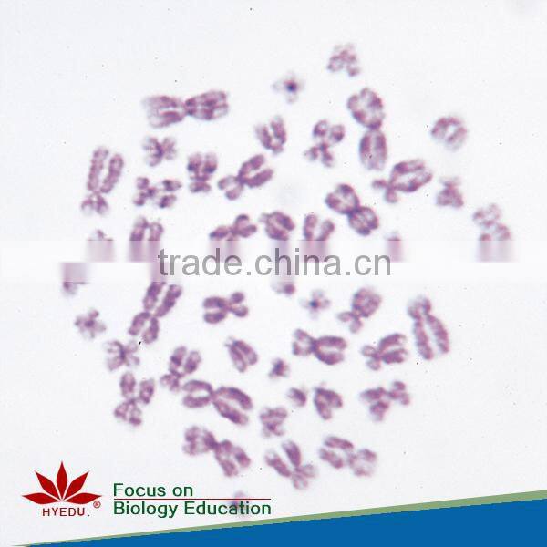 Fixed set 100 pieces for higher medical educational histopathology slides