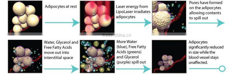 chinese weight loss product/portable 650nm lipo laser for cellulite reduction