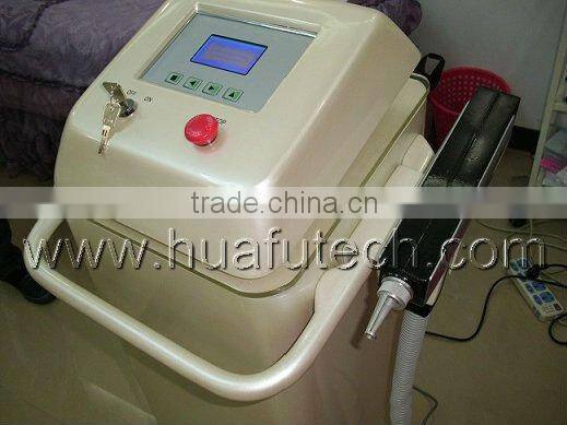 nd yag laser pigmentation machine laser tattoo removal