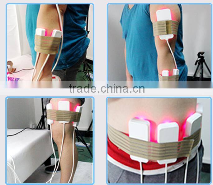 SALES 650 and 980nm i lipo diode laser slimming with 12 pads for fat burning easy operate lipo laser machine