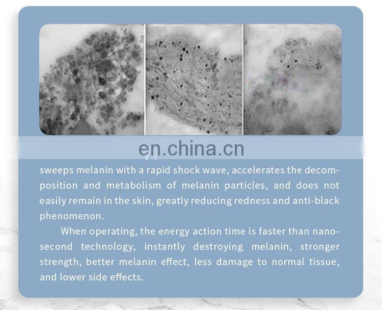 Portable Q-Switched 755 Pico Tattoo Removal Skin Rejuvenation Beauty Machine For Salon Use