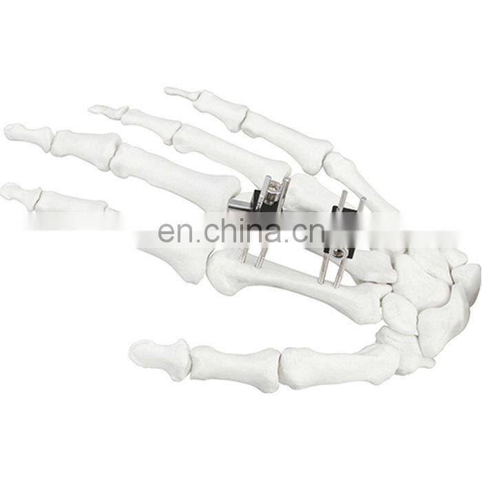 CE & ISO Marked Mini Fragment External Fixator (Finger and Palm) Surgical Instrument