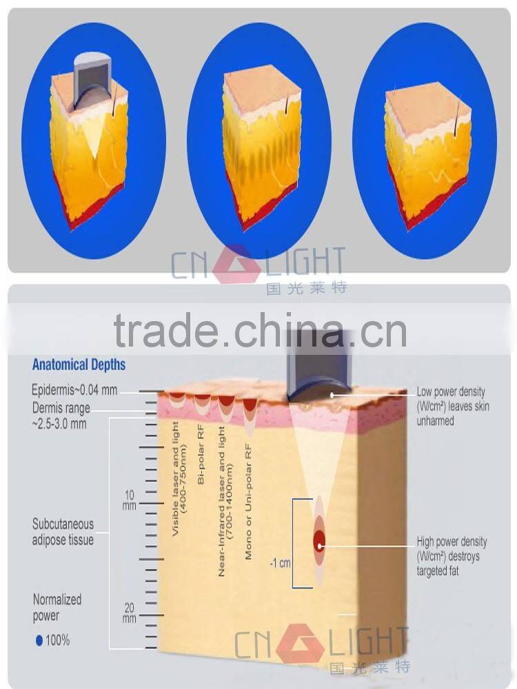 Merry christmas! professional high intensity focused ultrasound slimming weight balance lipo hifu machine