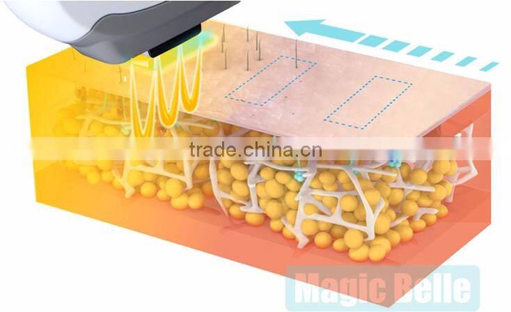 IPL SHR Machine/ Hair Removal Machine/IPL Skin Rejuvenation Machine