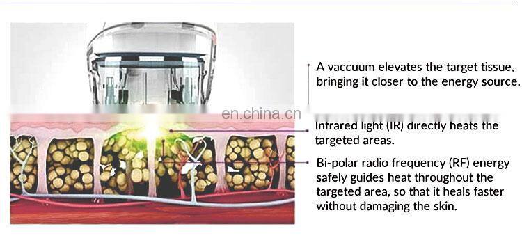 Best Seller 6 In 1 Vacuum Cavitation Machine Vacuum Cavitation System Cavitation RF Vacuum Slimming Machine