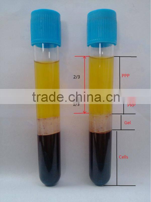 Steriled PRP tube used for PRP clinic